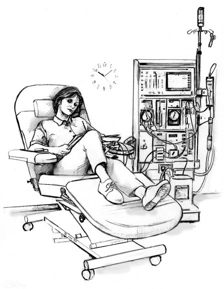 femeie in hemodializa